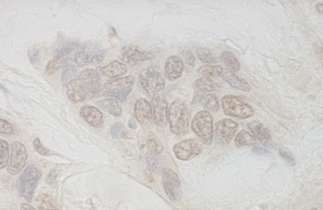 Rabbit anti-IBP160 IHC Antibody