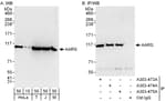 Detection of human and mouse AARS by western blot (h and m) and immunoprecipitation (h).