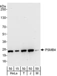 Detection of human and mouse PSMB4 by western blot.