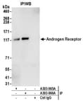 Detection of human Androgen Receptor by western blot of immunoprecipitates.