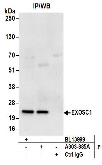 Detection of human EXOSC1 by western blot of immunoprecipitates.