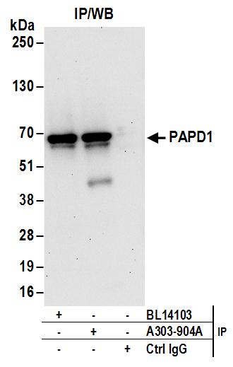 Detection of human PAPD1 by western blot of immunoprecipitates.