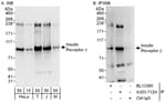 Detection of human and mouse Insulin Receptor Beta by western blot (h and m) and immunoprecipitation (h).