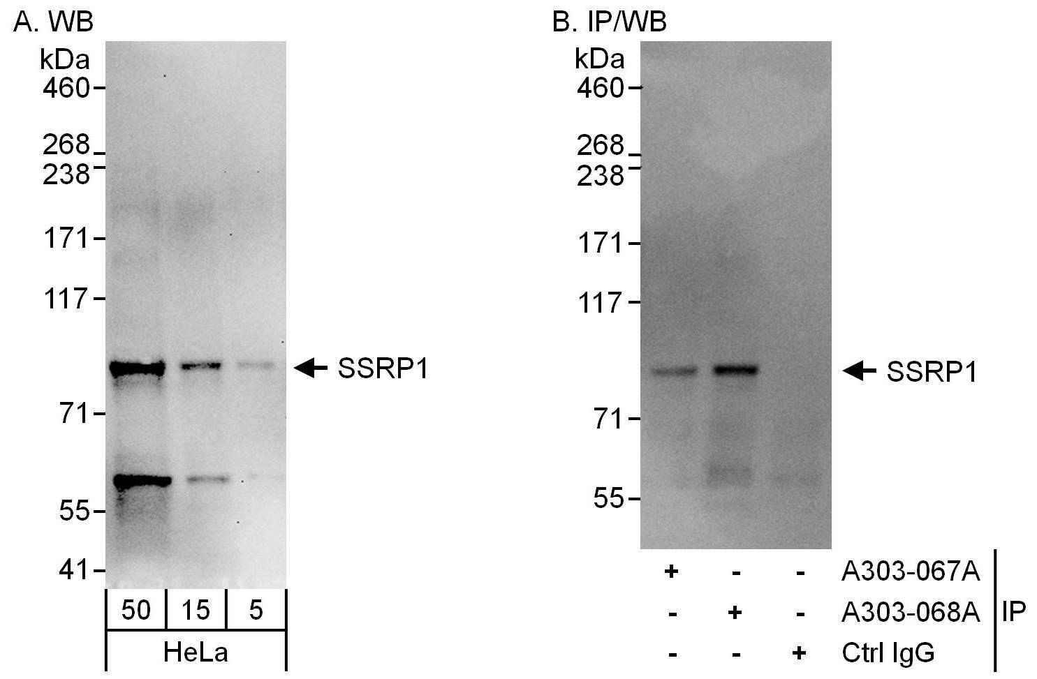 Detection of human SSRP1 by western blot and immunoprecipitation.