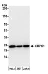 Detection of human CMPK1 by western blot.