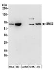 Detection of human and mouse SNX2 by western blot.