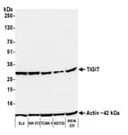 Detection of mouse TIGIT by western blot.