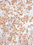 Detection of human ACTH by immunohistochemistry.
