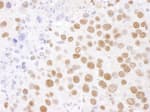 Detection of mouse SF3B4 by immunohistochemistry.