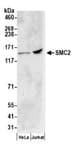 Detection of human SMC2 by western blot.