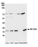 Detection of human MT-CO2 by western blot.