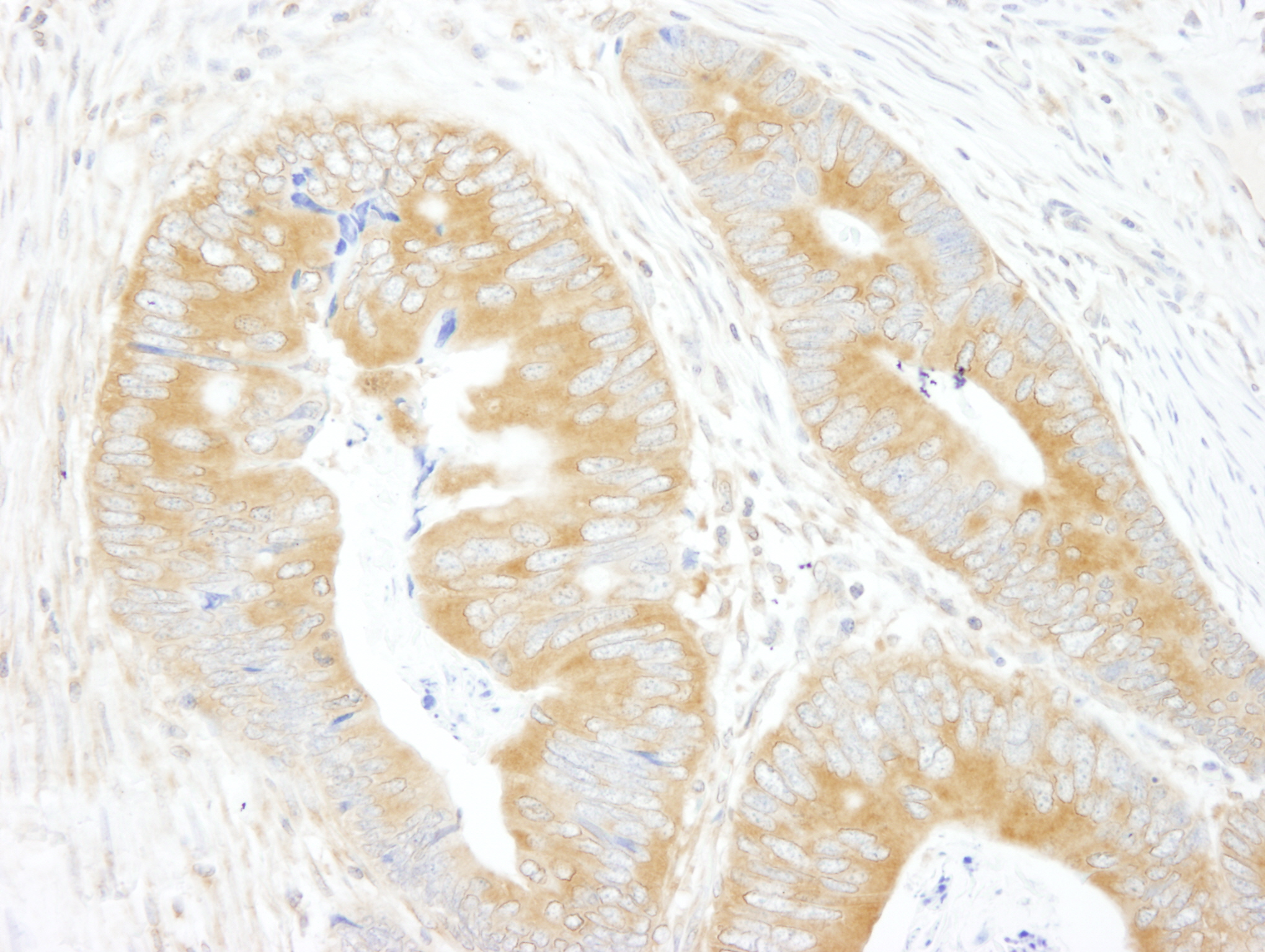 Rabbit anti-eIF3A/eIF3S10 IHC Antibody