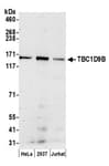 Detection of human TBC1D9B by western blot.