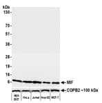 Detection of human MIF by western blot.