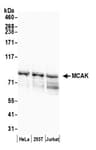 Detection of human MCAK by western blot.