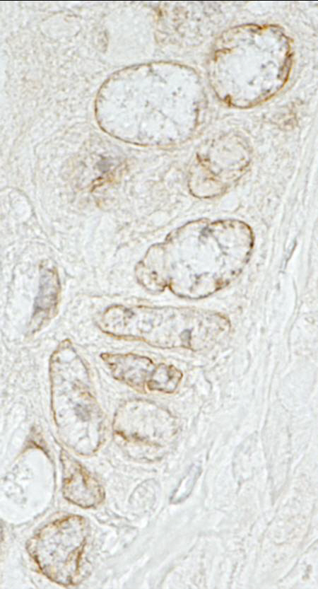 Rabbit anti-LAP1B IHC Antibody