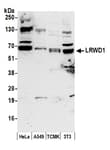 Detection of human and mouse LRWD1 by western blot.