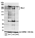 Detection of human MLL1 by western blot.