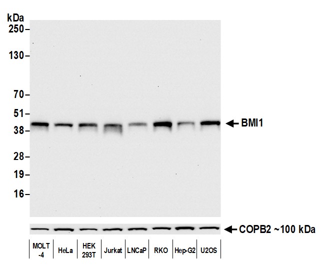 Rabbit anti-BMI1 Recombinant Monoclonal Antibody [BLR119H]