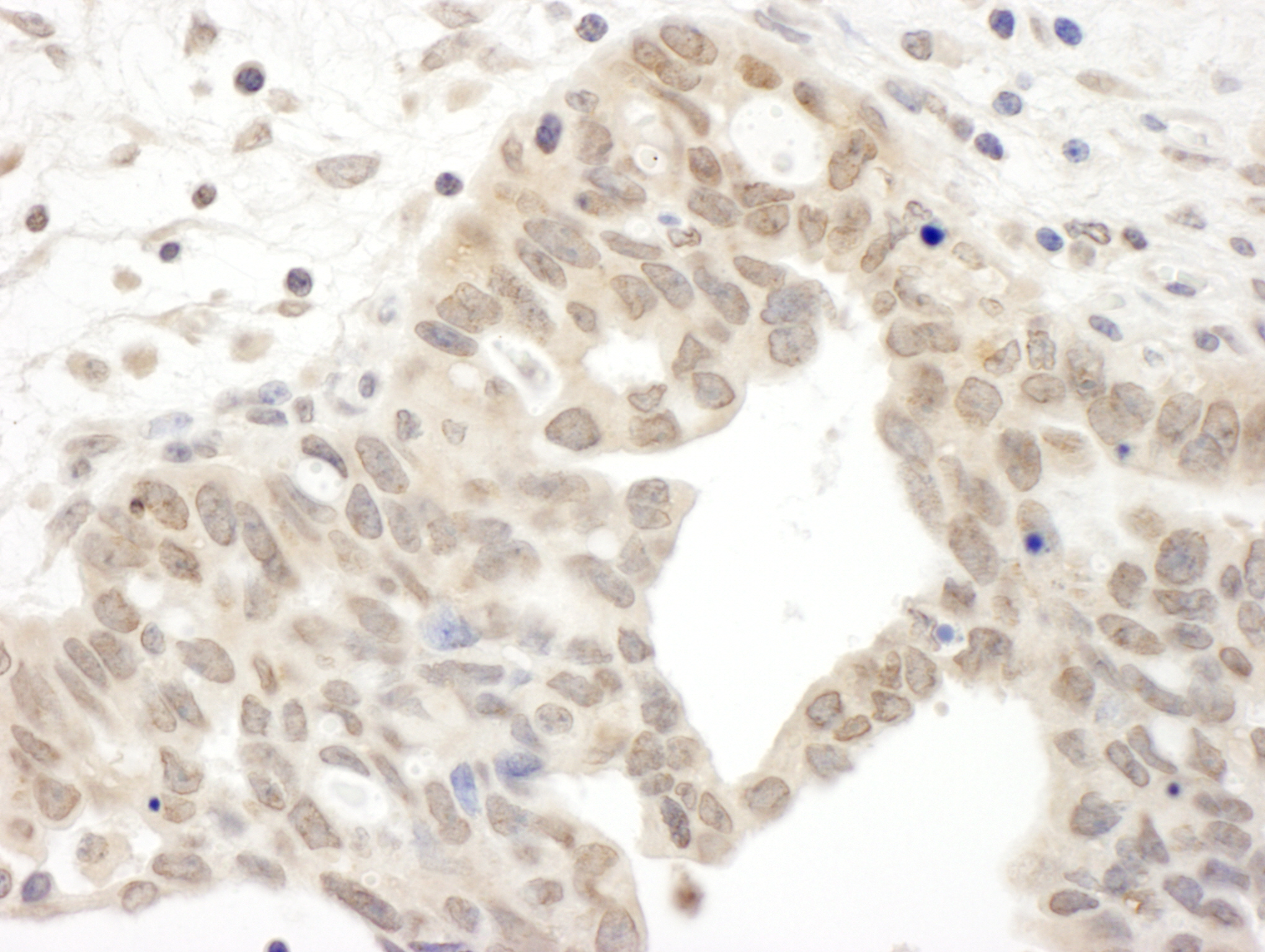 Rabbit anti-JAK2 IHC Antibody