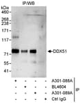 Detection of human DDX51 by western blot of immunoprecipitates.