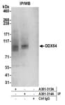 Detection of human DDX54 by western blot of immunoprecipitates.