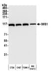 Detection of mouse IWS1 by western blot.