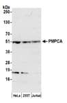Detection of human PMPCA by western blot.