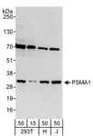 Detection of human PSMA1 by western blot.