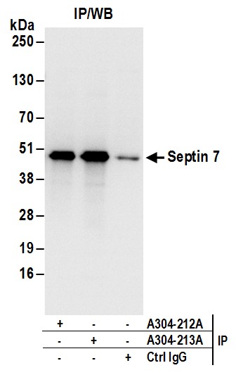 Detection of human Septin 7 by western blot of immunoprecipitates.