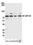 Detection of human CAP-H2 by western blot.
