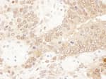 Detection of mouse ACAT2 by immunohistochemistry.