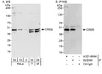 Detection of human and mouse CREB by western blot (h&amp;m) and immunoprecipitation (h).
