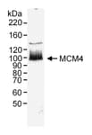 Detection of human MCM4 by western blot.