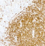 Detection of human HLA-DR by immunohistochemistry.