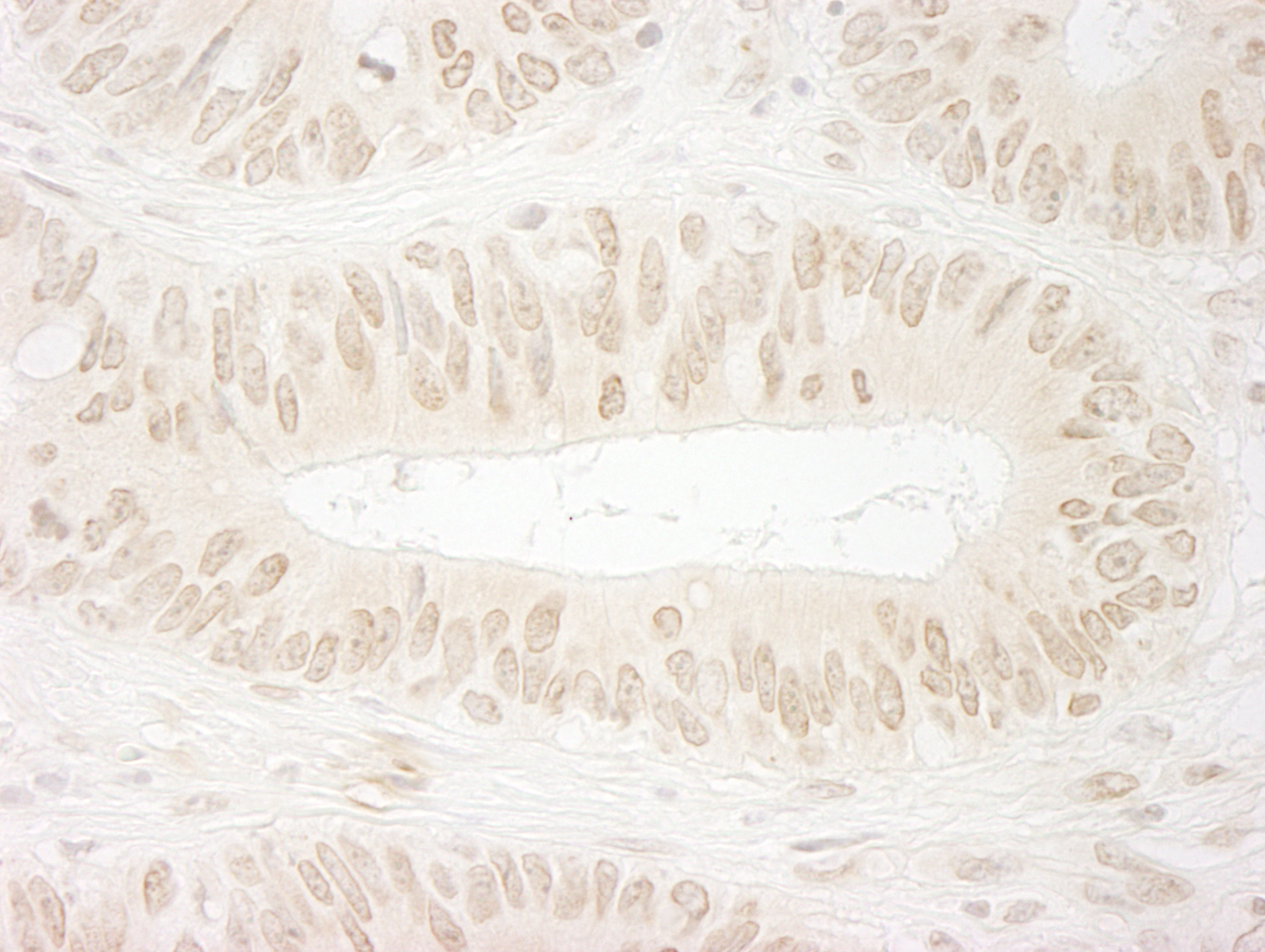Rabbit anti-SSB1 IHC Antibody