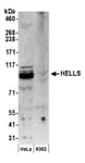 Detection of human HELLS by western blot.