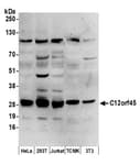 Detection of human and mouse C12orf45 by western blot.