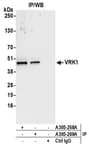 Detection of human VRK1 by western blot of immunoprecipitates.