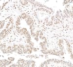 Detection of human RbBP5 by immunohistochemistry.