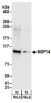 Detection of human NOP14 by western blot.