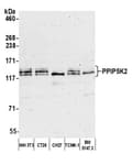 Detection of mouse PPIP5K2 by western blot.