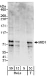 Detection of human MID1 by western blot.