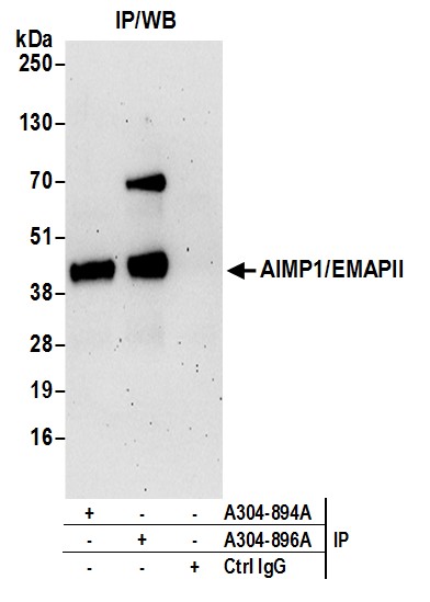 Detection of human AIMP1/EMAPII by western blot of immunoprecipitates.