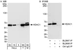 Detection of human and mouse HDAC1 by western blot (h&amp;m) and immunoprecipitation (h).