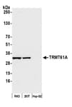 Detection of human TRMT61A by western blot.