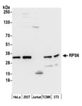 Detection of human and mouse RPS6 by western blot.