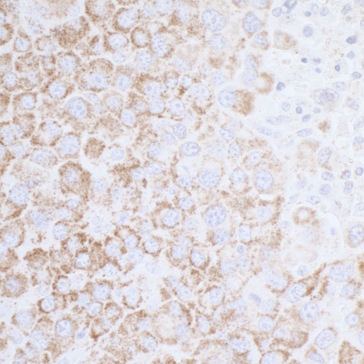 Detection of mouse ATP5A1 by immunohistochemistry.