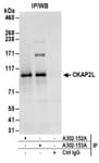 Detection of human CKAP2L by western blot of immunoprecipitates.
