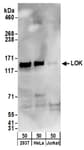 Detection of human LOK by western blot.